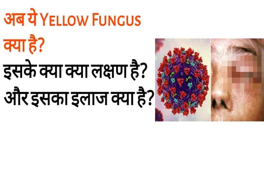 yellow 2Bfungus 2B min